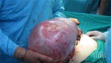 Хирурзи извадиха 20-килограмова киста от жена в Стара Загора