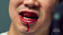 Зверство в Разград! Шизофреник нападна, яде и пи кръв от друг пациент
