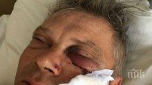 30 побеснели роми с каруци утрепаха рускак и сина му заради спорна ливада 