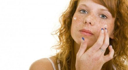 глава лук заличава луничките