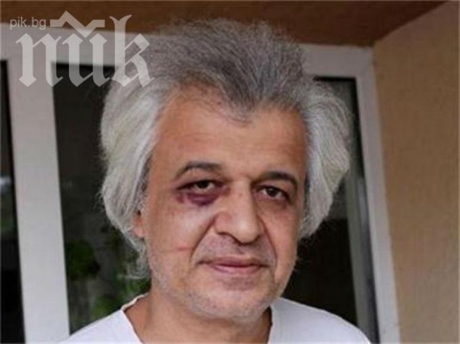 Собственик на сграда преби наемател-журналист