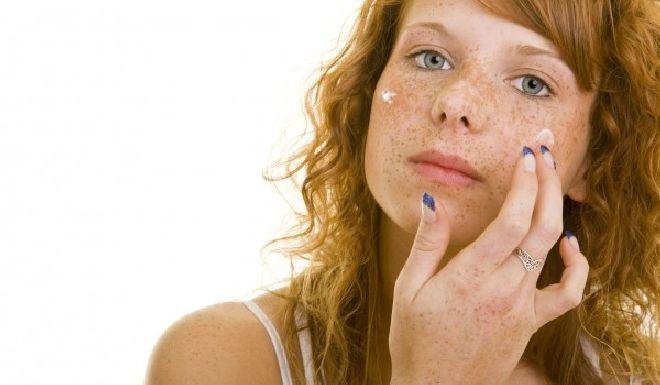 Глава лук заличава луничките