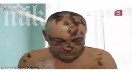 ужас нов наркотик оставя употребилите кожа влечуго