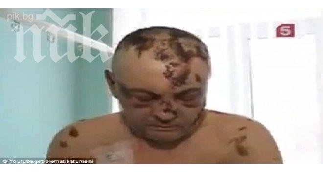 Ужас! Нов наркотик оставя употребилите го с кожа като на влечуго