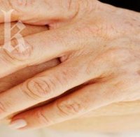 Старчески петна не се премахват