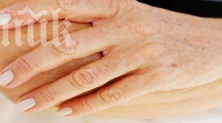 старчески петна премахват