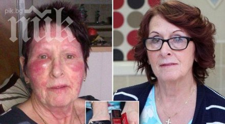 ужасяващо крем против бръчки съсипа лицето годишна жена снимки