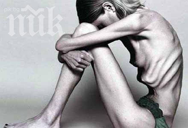 Трагедия! Бургазлийка почина от анорексия, тежейки 18 килограма