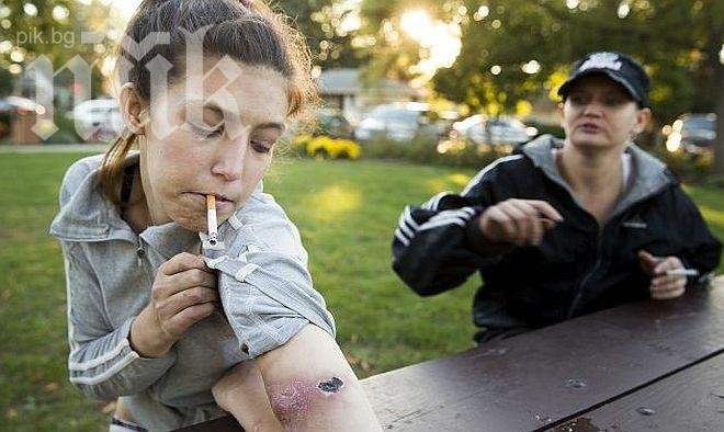 Нова дрога разяжда до кокал плътта на наркоманите (снимки 18+)