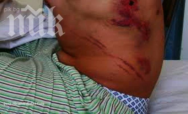 Изнасилиха млад мъж след як побой в Бургас, оказа се наркодилър