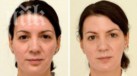 чудотворен ефект жена подмлади години пиене вода