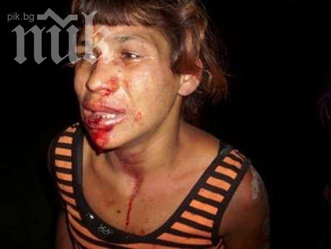 Скинари пребиха жестоко бременна циганка! 