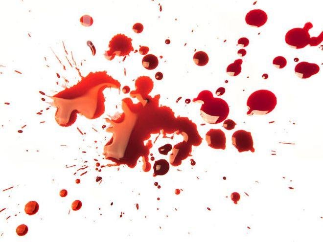 Разбит череп след масов бой в село Гърмен