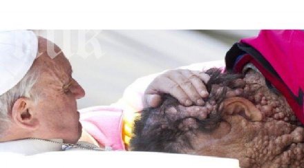 папата целуна клетник покрит тумори цялото тяло