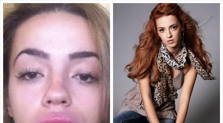 претендентка мис българия обезобрази жестоко козметична процедура