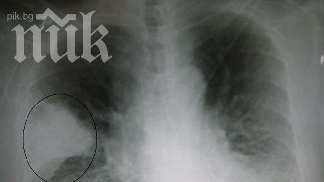 Плашеща статистика! На всеки 30 секунди едно дете умира от пневмония