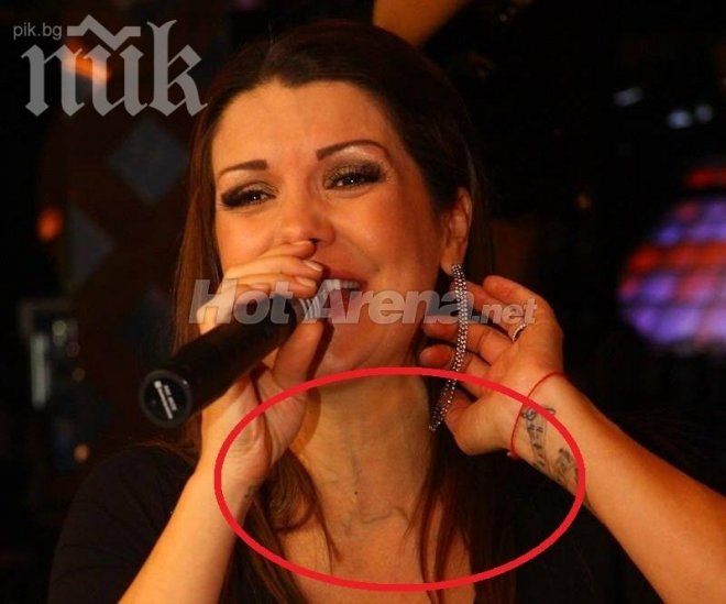 Бременната Кали застрашава себе си и бебето. Вижте защо!