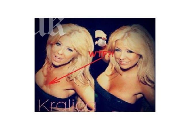 Кошмар! Гръмна силикона на Андреа (снимка)