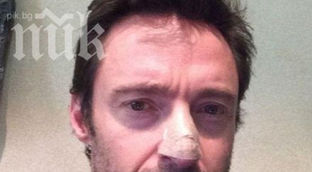 джакман обяви болен рак