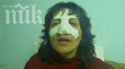зверство циганин преби невинна жена счупи носа снимка