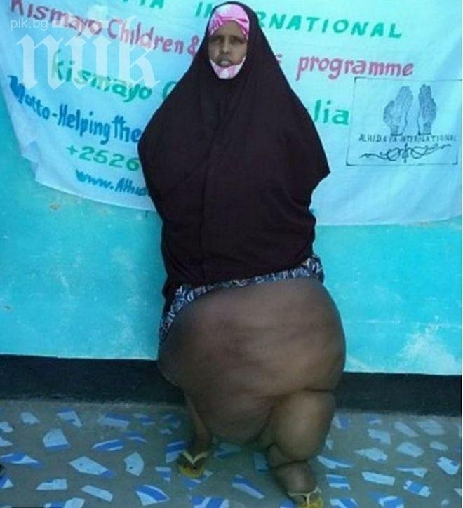 Жена с 40 кг крак – съседите й мислят, че в нея се е вселил дяволът (снимка)