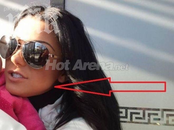 Мистерия! Емануела с оток на бузата, подозират побой