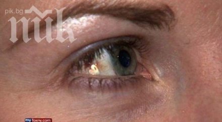 жена имплантира платинено бижу окото