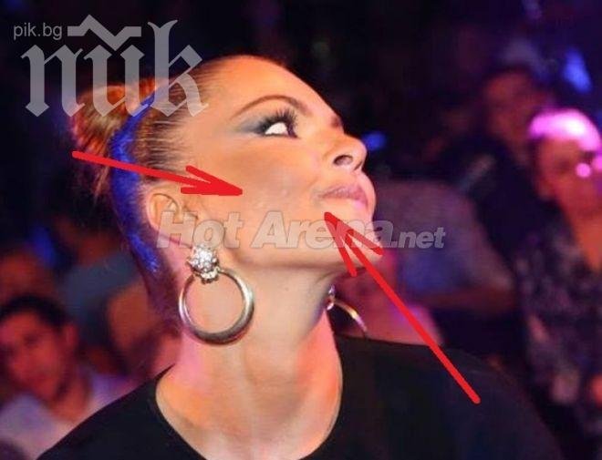 Галена се появи на участие с посинено лице! Пребита ли е певицата?