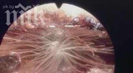 глухарче израсна ухото бебе снимка