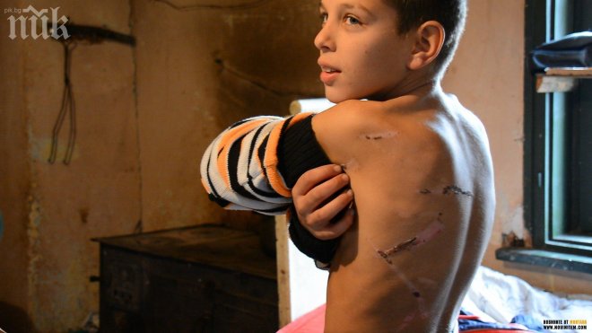 Мъжът, жигосал дете с пирон, обичал да пие. Майката за зверството: Случва се за пръв път