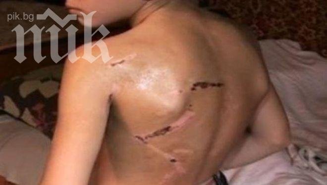 Жигосаното дете: Въргалях се в снега и малко спря да ме пари (снимка)