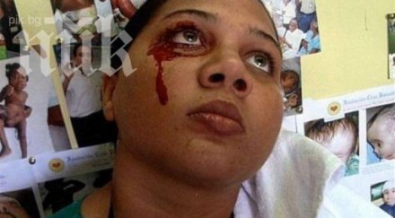 рядка болест кара жена плаче поти кръв снимка видео