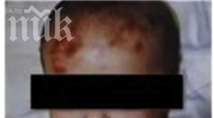 оперираха спешност пребитото годишно дете състоянието остава критично