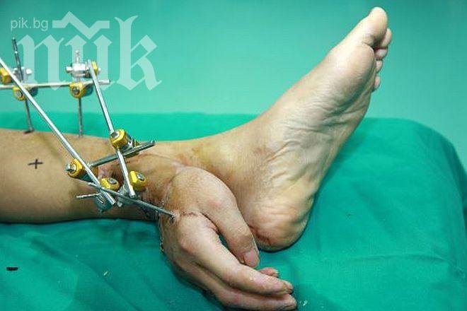 Китайски хирурзи присадиха ръка върху ...крак (видео)