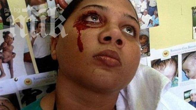 Рядка болест кара жена да плаче и да се поти с кръв (снимка + видео)