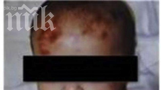 Оперираха по спешност пребитото 2-годишно дете, състоянието му остава критично