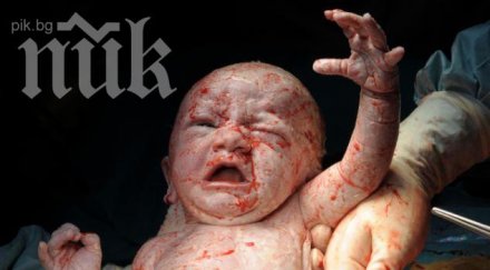 изваждат бебе утробата майка ражда нов живот дъхът спре снимки