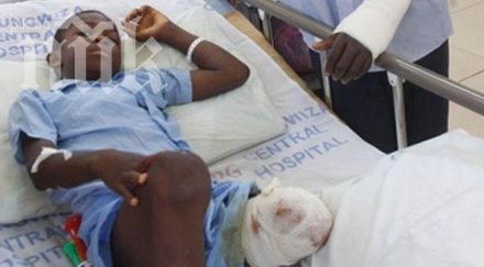 баща смаза бой крокодил откъснал крака детето снимка