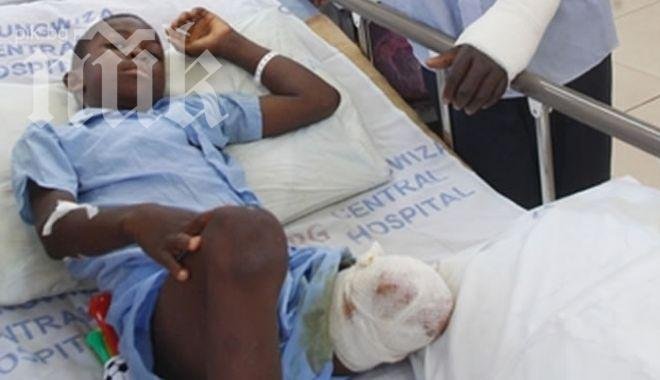 Баща смаза от бой крокодил, откъснал крака на детето му (снимка)