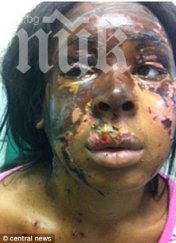 студентка заля приятелката киселина покъртителни снимки