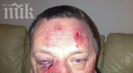 шокираща жестокост внуци ослепиха бой дядо