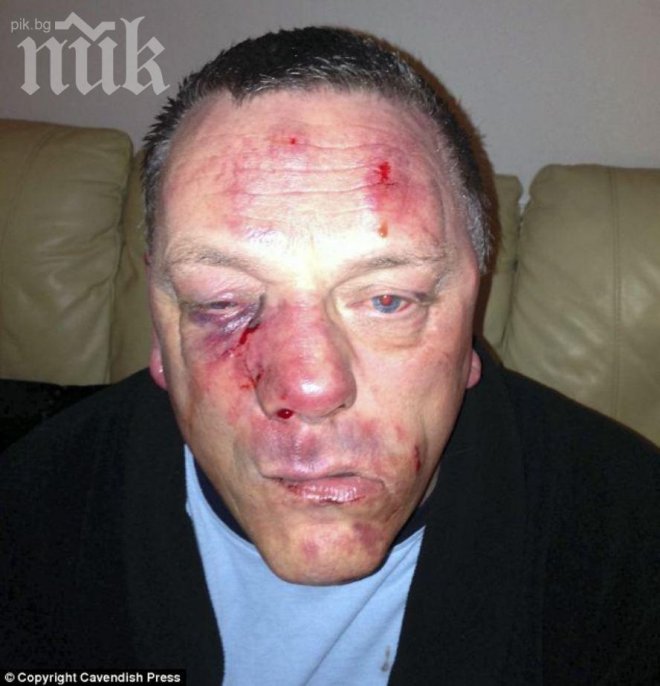 Шокираща жестокост! Внуци ослепиха от бой дядо си