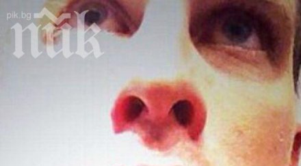 вижте зловещата спортна контузия снимка