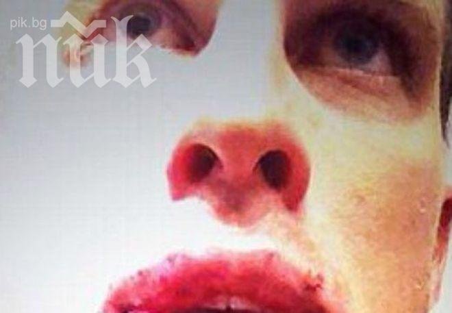 Вижте най-зловещата спортна контузия (снимка 18+)