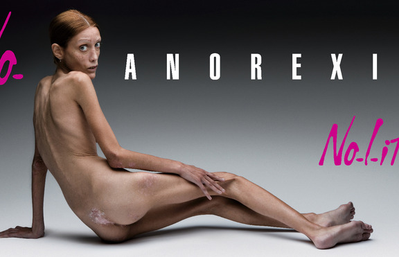Ужас! 200 000 българи имат наченки на анорексия
