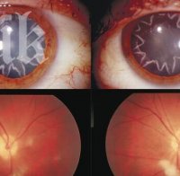 Електрошок от 14 000 волта е докарал на този мъж перде с формата на звезда (снимка)