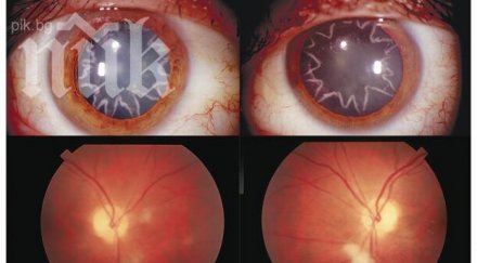 електрошок 000 волта докарал мъж перде формата звезда снимка