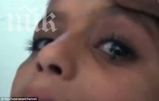 Момиче шокира лекарите! Вместо сълзи от очите му текат камъни! (видео)