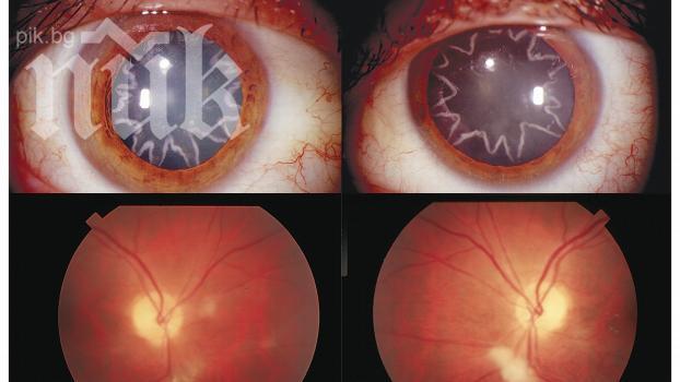 Електрошок от 14 000 волта е докарал на този мъж перде с формата на звезда (снимка)