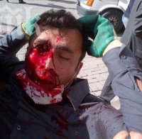 Един човек загина, а 77 бяха ранени при протест в Папуа Нова Гвинея